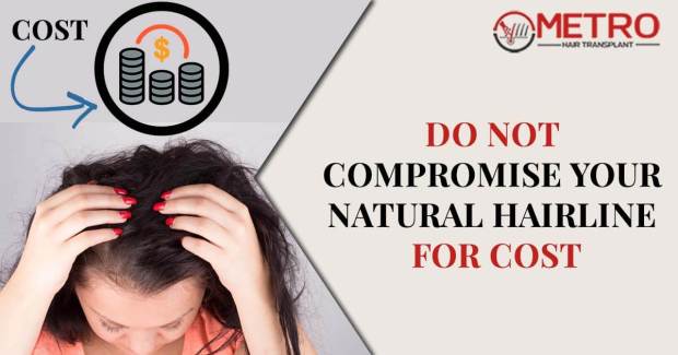 Do not compromise your natural hairline for cost