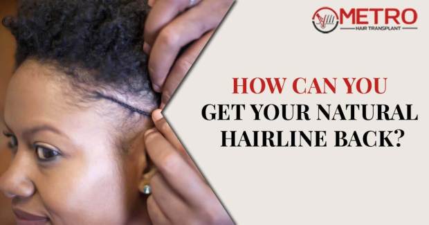 How can you get your natural hairline back?