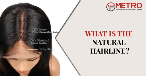 What is the natural hairline?